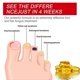 thumbnail image 2 of ExquisiteNail Repair Oil, Nail Repair Liquid for Growth, Mild Cuticle Conditioner, Nail Strengthener for Nails, Children, Adults, 2 of 5