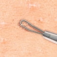 thumbnail image 2 of Beaute Galleria Stainless Steel Double Loop Pimple Remover, Blackhead, Blemish, Acne Extractor, 2 of 5