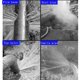 thumbnail image 4 of Detector de Fugas de Agua Subterránea, Dispositivo de Detección de Fugas de Agua Con Sonda -70D DB, Amplificación de Sonido 20000x, Auriculares de Soporte, Monitor de Tuberías, 4 of 7