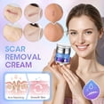 thumbnail image 4 of Crema cicatricial Reatoy Silicone 55 ml para cicatrices quirúrgicas con 3% de dimeticona, 4 of 8