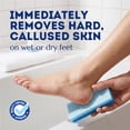 thumbnail image 3 of Livhil 4 Pack 2-in-1 Foot Pumice Stone for Feet, Double Sided Foot Stone for Dead Skin Feet Pedicure Stone for Callus Remover and Scrubber (Blue), 3 of 8