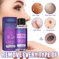 thumbnail image 2 of EELHOE 30ML/Botella Eliminador de verrugas Líquido para eliminar verrugas con aguijón, 2 of 8