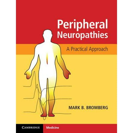 Peripheral Neuropathies (Best Doctor For Peripheral Neuropathy)