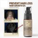 thumbnail image 3 of HOTBest all natural 20ML Nuevo Spray Para El Crecimiento Del Cabello Rápido Tratamiento Anti Caída Prevención De Productos, 3 of 3