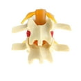 thumbnail image 4 of Modelo De Demostración De Herniación Discal Degenerativa De s Vértebras es De Vertebral Anatómica, Herramientas CUTICAT Estatua de protrusión del disco lumbar, 4 of 7