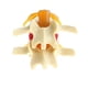 thumbnail image 4 of Nuevo o De Protrusión D Intervertebral De Zulema Estatua de protrusión del disco lumbar, 4 of 7