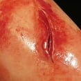 thumbnail image 2 of TrueClot Wound Packing Training Kit, Laceration, 2 of 7