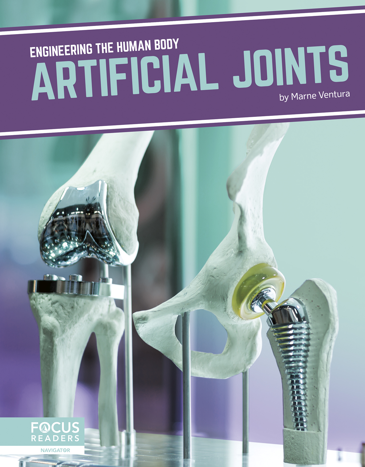 Artificial Joints (Hardcover)