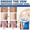 thumbnail image 5 of 8 Uds Parche para Venas Varicosas Alivio Del Dolor Vasculitis Flebitis Yeso, 5 of 5