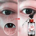 thumbnail image 4 of 7 Days Eye Bag Remove Dark Circles Hyaluronic Acid Eye Essence Anti Wrinkle Firming Eye, 4 of 5
