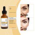 thumbnail image 4 of Hot6sl Liquidación de Ahorros de Verano Esencias de Vitamina C Aclarantes de Manchas Reduce Las Arrugas Esencias Reafirmantes 30 Ml, 4 of 7