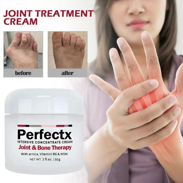 PERFECTX Joint Bone Colágeno Crema Para Alivio Del Dolor De Huesos  Articulares Deformación Corrección Para Aliviar El Las Articulaciones El  Cuidado De La Piel 30g | Walmart en línea