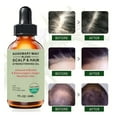thumbnail image 5 of Autorización Aceite para el cuidado del cabello Essence Oil para prevenir la sequedad, el frizz, humectar, suavizar y reparar el cabello quebradizo\30 ml (compre 2 y ahorre un 10 %), 5 of 5