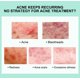 thumbnail image 4 of Herbal Removing Cream,Herbal Cream Facial Cream Plant Cream 15g, 4 of 9