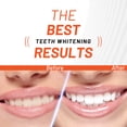 thumbnail image 6 of White Glo Deep Stain Removing Activated Charcoal Teeth Whitening Powder, Peppermint, Enamel Safe, 1.05 oz (30g), 6 of 9
