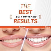 White Glo Deep Stain Removing Activated Charcoal Teeth Whitening Powder, Peppermint, Enamel Safe, 1.05 oz (30g)