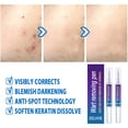 thumbnail image 4 of 2 uds removedor de verrugas pluma para etiquetas de piel papilomas eliminación de lunares herramientas de punto indoloras Sywqhk Cuidado Belleza, 4 of 7