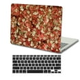 thumbnail image 1 of KSK KAISHEK Hard Shell Case for Old MacBook Pro 15 inchs( No Touch, 2012 - 2015) + Black Keyboard Cover Model A1398, No CD-ROM Flower 68, 1 of 5