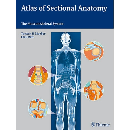 Atlas of Sectional Anatomy: The Musculoskeletal System [Hardcover - Used]