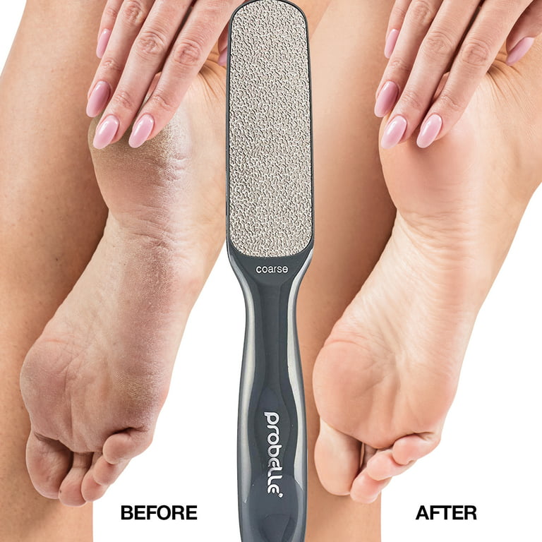 Probelle Double Sided Multidirectional Nickel Foot File Callus Remover -  Immediately Reduces Calluses and Corns To Powder For Instant Results, Safe  Tool (Dark Grey) 
