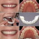 thumbnail image 4 of Un par superior e inferior de alta calidad dentadura instantánea sonrisa comodidad ajuste flexible dientes cosméticos dentadura postiza superior chapa cosmética de alta calidad Bdl, 4 of 5