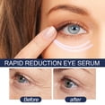 thumbnail image 5 of Sérum pour les Yeux - Formule Avancée Sérum à Réduction Rapide - 0.1 oz, 5 of 5