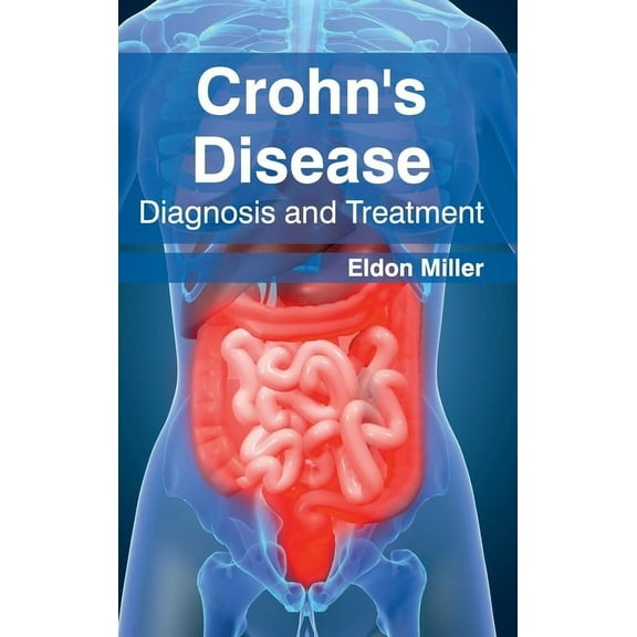Crohn's Disease: Diagnosis and Treatment, (Hardcover)