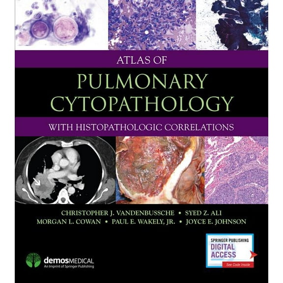 Atlas of Pulmonary Cytopathology, (Hardcover)