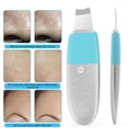 thumbnail image 2 of Dispositivo de limpieza de la piel, limpiador facial 3 en 1, eliminador de puntos negros, eliminador de acné, depurador de piel ultrasónico eléctrico para, 2 of 7
