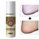 thumbnail image 4 of 3x Foot Spray Anti-fungal Infection Beriberi Spray Damaged Skin Moisturizer, 4 of 5