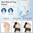 thumbnail image 6 of Bunion Corrector for Women & Men with Adjustable Knob Silicone Pad, Bunion Relief Big Toe Splint for Left/Right Feet, Black, 6 of 10
