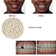 thumbnail image 5 of Pegamento sólido para dientes postizos LHCER 50g Blanqueamiento dental, 5 of 9