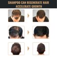 thumbnail image 3 of Shampooing Cheveux pour l'Amincissement des Cheveux Shampooing Volumisant 3pcs 100ml Shampooing de Repousse des Cheveux Ingrédients à Base de Plantes Renforcer Cheveux Racine Shampooing de Réparation des Cheveux, 3 of 8