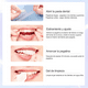 thumbnail image 2 of Tiras Bandas Blanqueadoras Tratamiento Dental 9d 14 Sobres, 2 of 7