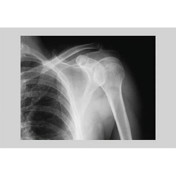 Shoulder-Fine Art Canvas Print (20" x 30")