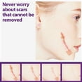 thumbnail image 3 of Scar Removal Sheets, 8ps Easy To Clean Scar Sheets Soft Reduce Scar Tissue Improve Skin Elasticity  for C Section, 3 of 8