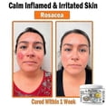 thumbnail image 4 of Bee Venom cream for skin treatment multi symptom relief, 4 of 5
