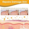 thumbnail image 3 of 3Pcs Tag Recede Bee Venom, Tag Recede Bee Venom Treatment Spray Tag Recede Bee Venom, 3 of 5