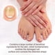 thumbnail image 3 of Treatment for Weak Nails, 20ml Nail Strengthener to Repair Brittle and Soft Nails, 3 of 5