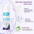 thumbnail image 3 of Crema de silicona para cicatrices Scar Gel Yarster, 50 ml, para cicatrices nuevas y antiguas, 3 of 8