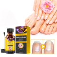 CENGZISHU Fingernail Polish Remover Onychomycosis Care Solution