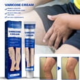 thumbnail image 4 of Crema Para Venas Varicosas Crema de masaje Crema de alivio de venas varicosas a base de hierbas para Vasculitis Flebitis Araña Sywqhk Cuidado Belleza, 4 of 9