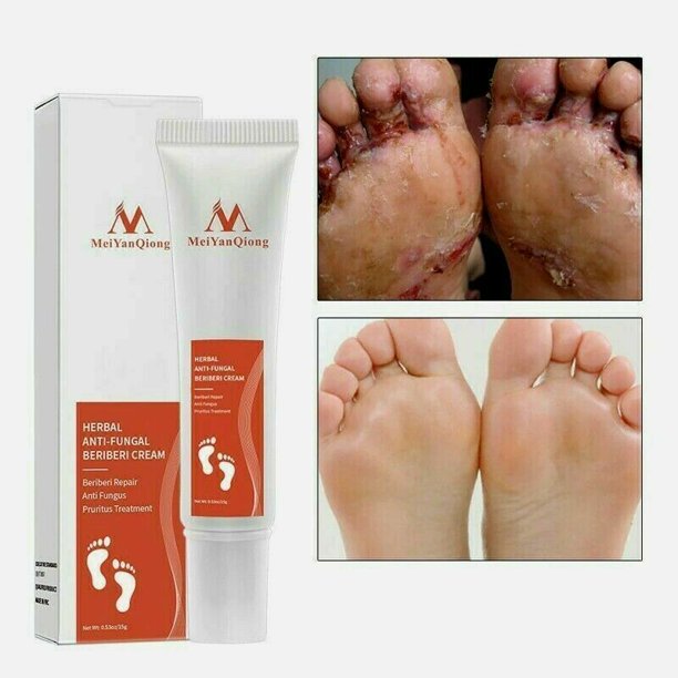 Herbal Foot Cream Anti Fungal Infection Fungus Gel Repair Dry Crack Toe