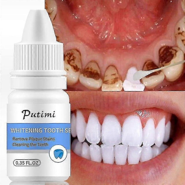 Suero blanqueador dental, gel blanqueador para la higiene bucal, elimina las manchas de placa, limpieza y blanqueamiento dental.