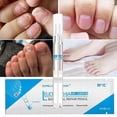 thumbnail image 3 of 3/1pcs Fungal Nail Treatment Pen Anti Fungal Onychomycosis Paronychia Nail Care Liquid, 3 of 5
