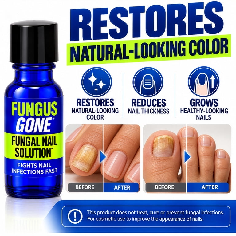Nail-Aid Fungus Gone Maximum Strength Serum photo 5
