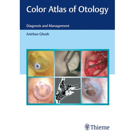 UPC: 9789390553761 | Color Atlas of Otology: Diagnosis and Management (Hardcover)