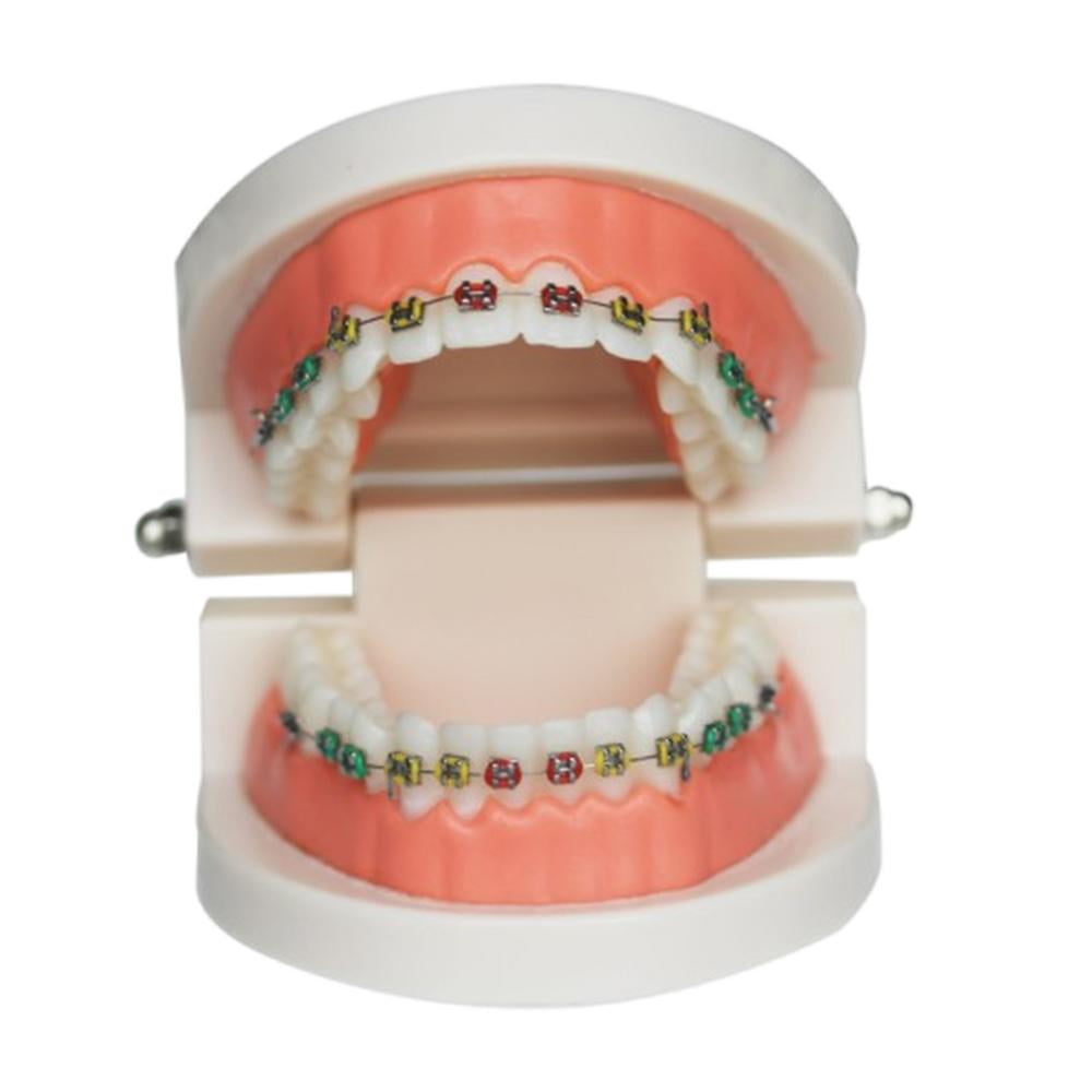 Fake Braces, Kids Fake Braces Lip Protector Colorful Braces Wire, Teeth Braces Wire, Stylish Teeth Cosplay Braces for Dentists, Kids