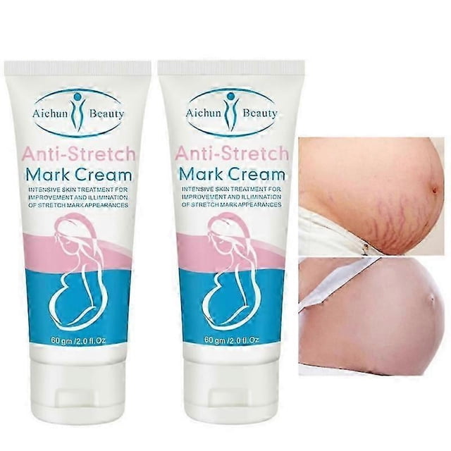 Crema para eliminar estrías con caracoles para eliminar la obesidad posparto, crema corporal reafirmante antiarrugas y antienvejecimiento para mujeres embarazadas, 2 unidades