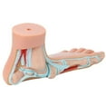thumbnail image 4 of Axis Scientific Anatomy Model of Human Foot | Podiatry Model is a Set of 3 Human Feet | Foot Model Shows the Common Foot Conditions Flat Foot, Normal Foot and a High Arch, 4 of 8